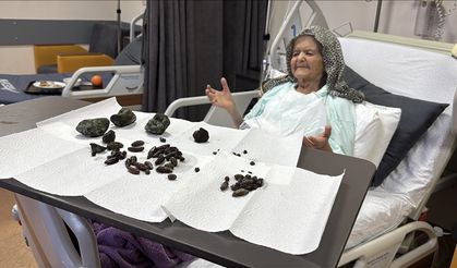 Zonguldak'ta 92 yaşındaki kadın yuttuğu zeytin ve hurma çekirdekleri nedeniyle ameliyat edildi